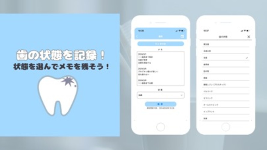 My Teeth - 歯の健康管理アプリのスクリーンショット_2