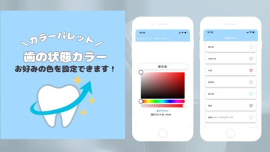 My Teeth - 歯の健康管理アプリのスクリーンショット_4