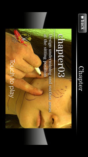 アジア人の為の腫れないフェイスネックリフト 手術映像のスクリーンショット_3