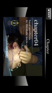 アジア人の為の腫れないフェイスネックリフト 手術映像のスクリーンショット_4