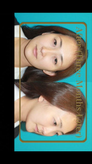 アジア人の為の腫れないフェイスネックリフト 手術映像のスクリーンショット_5