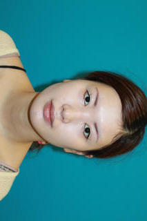 鼻尖形成術・耳介軟骨移植のスクリーンショット_2