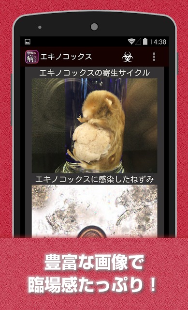 恐怖の病 寄生虫・奇病・感染症 人体に振りかかる本当の恐怖のスクリーンショット_4